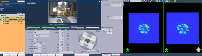 TrueBeam Screenshot